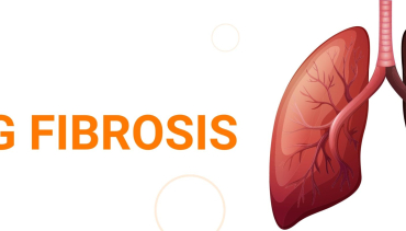Chest/Lungs