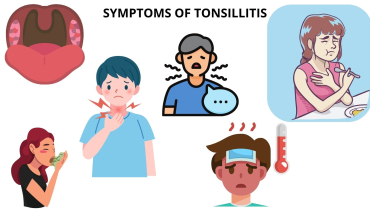 Throat Tounsils
